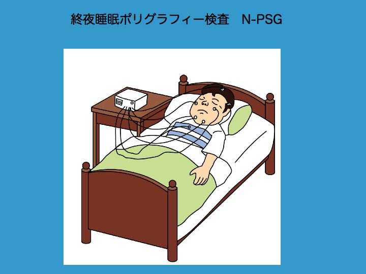 �I�鐇���|���O���t�B�[